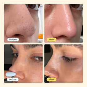 luelle strip close-up texture highlighting adhesive layer for efficient blackhead lift