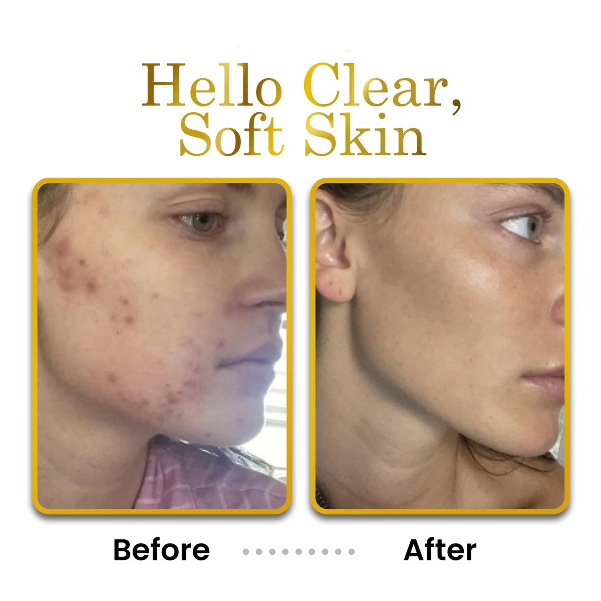 Luxe Beauty hands before and after use showing visible softness and improved skin feel