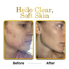 Luxe Beauty hands before and after use showing visible softness and improved skin feel