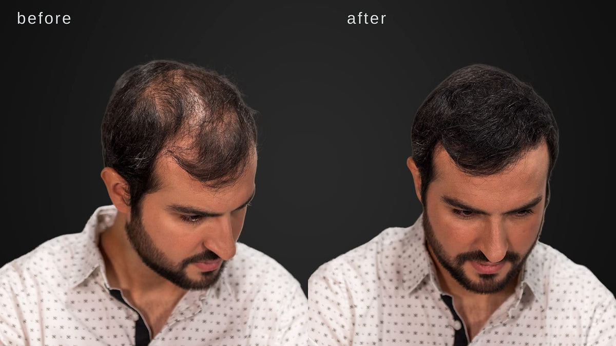 LUXE Professional before and after comparison demonstrating thicker-looking hair benefit
