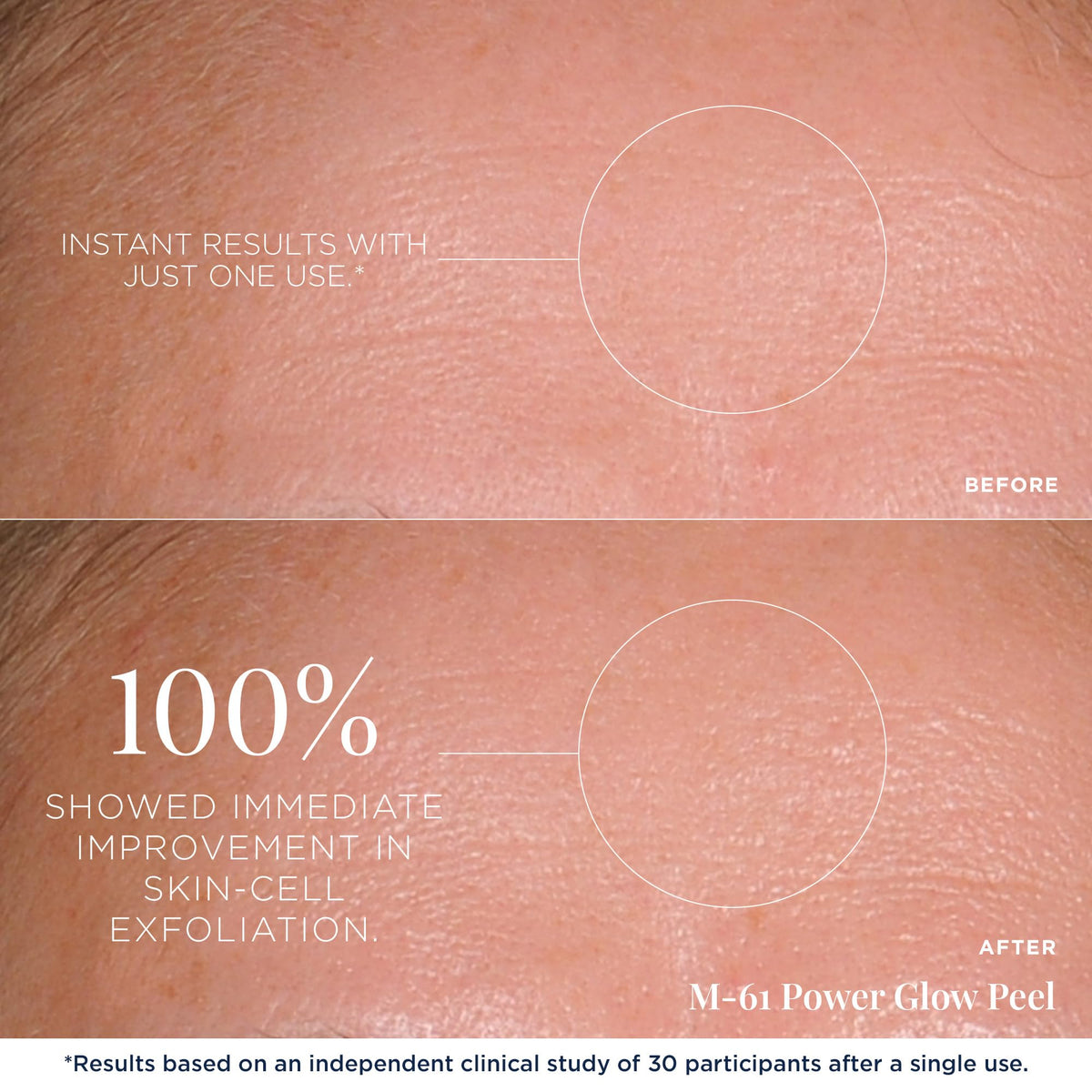 m-61 pad being applied to face demonstrating quick one-minute use