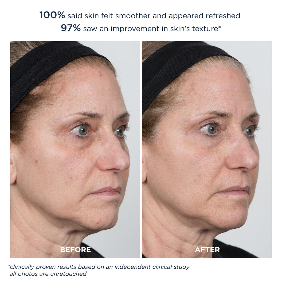 m-61 before and after skin images showing improved texture