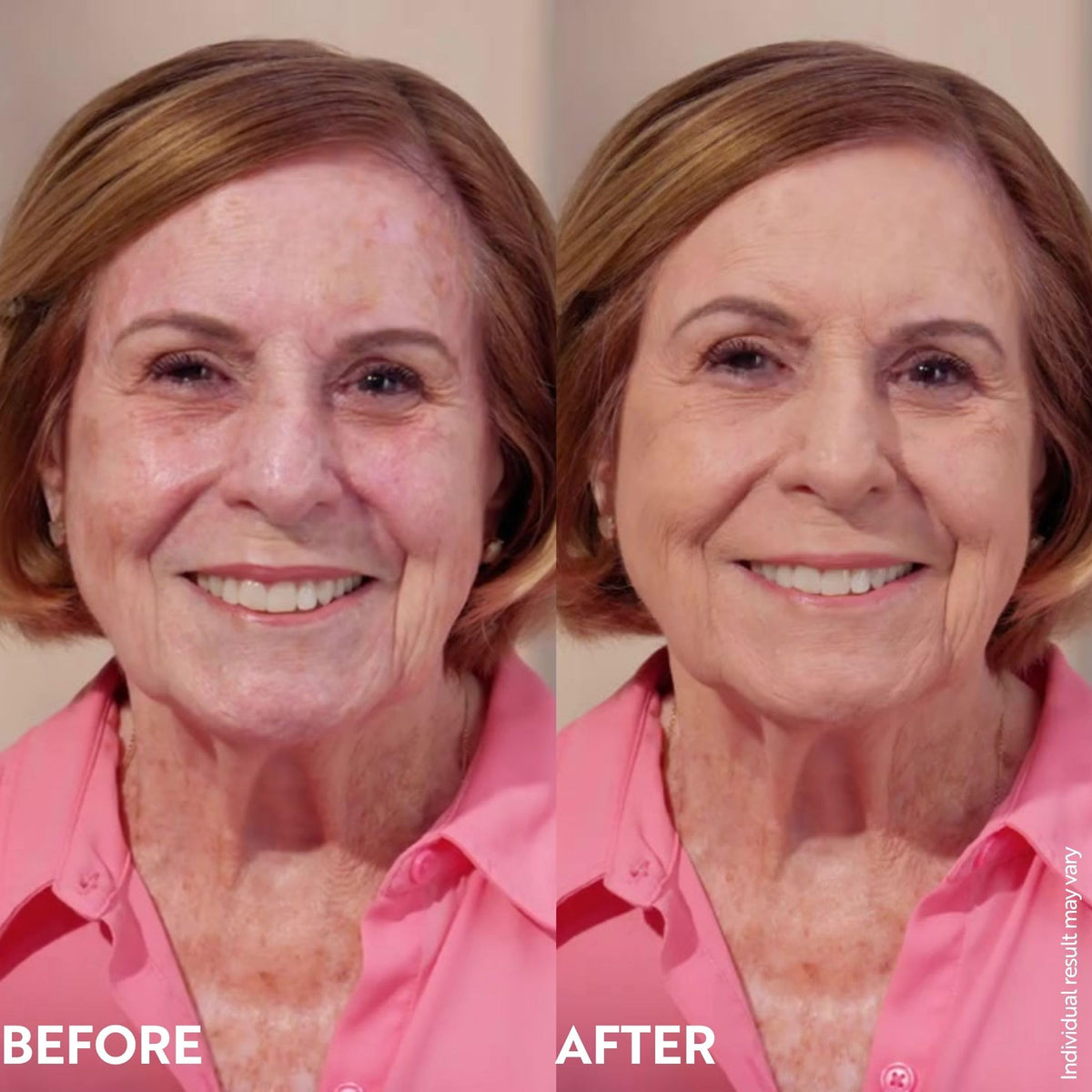 M. Asam before and after correcting redness and evening skin tone