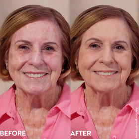 M. Asam before and after correcting redness and evening skin tone