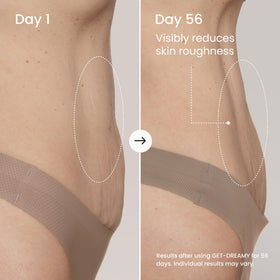 MAËLYS application on thigh demonstrating how it smooths and hydrates
