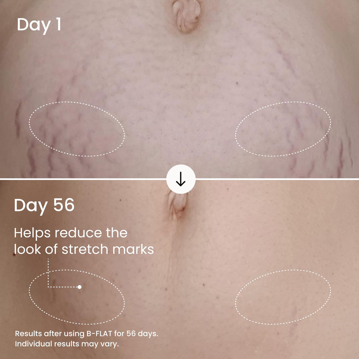 MAËLYS applying cream to belly to improve hydration and smoothness