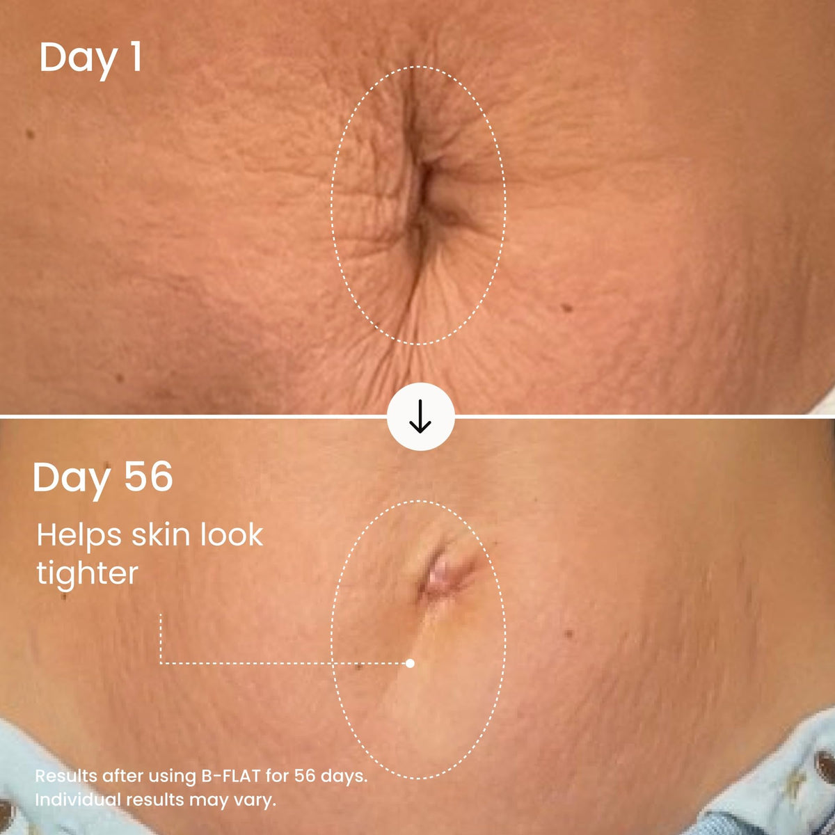 MAËLYS side-by-side comparison showing improved belly texture