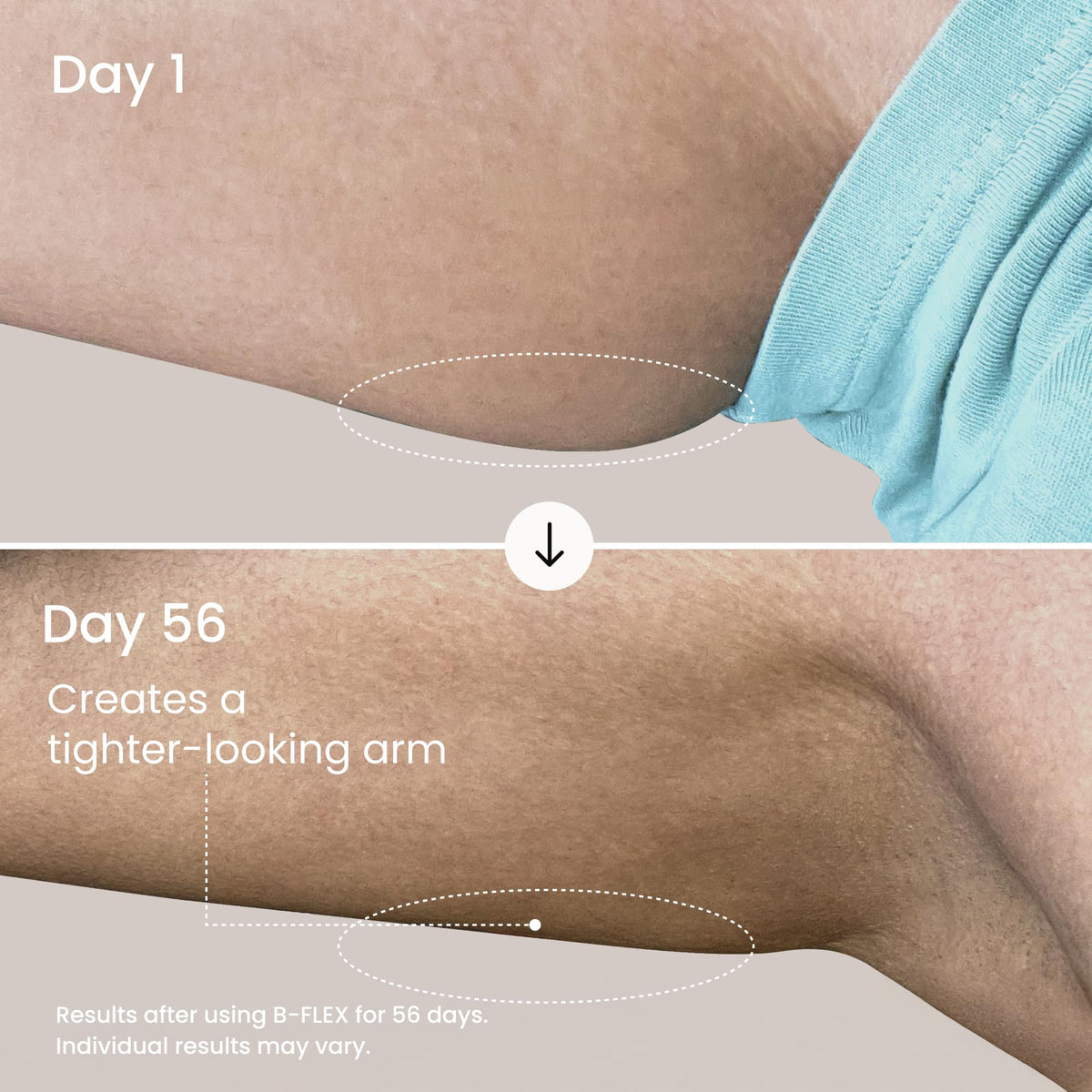 MAËLYS B-FLEX applied to upper arm demonstrating how to massage cream for firmer-looking skin
