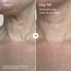 MAËLYS being applied to neck demonstrating lifting motion and smoother look