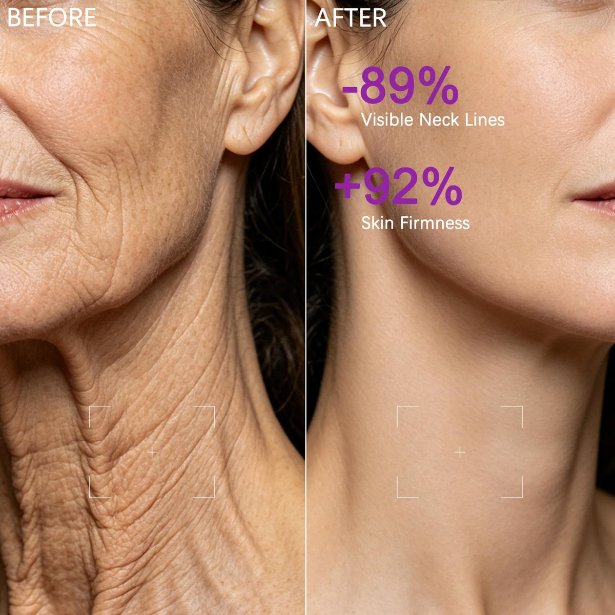 MAGEC applying cream with roller on neck, promotes absorption and contouring