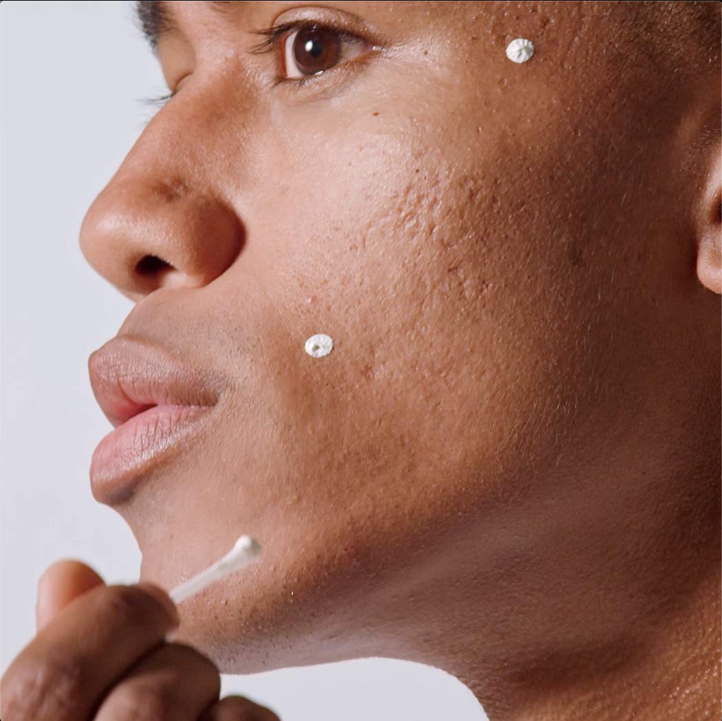 MALIN+GOETZ product applied to a single blemish before sleep, helps reduce redness