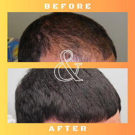 Mane Regain solution texture closeup showing clear topical liquid for easy absorption and even spread