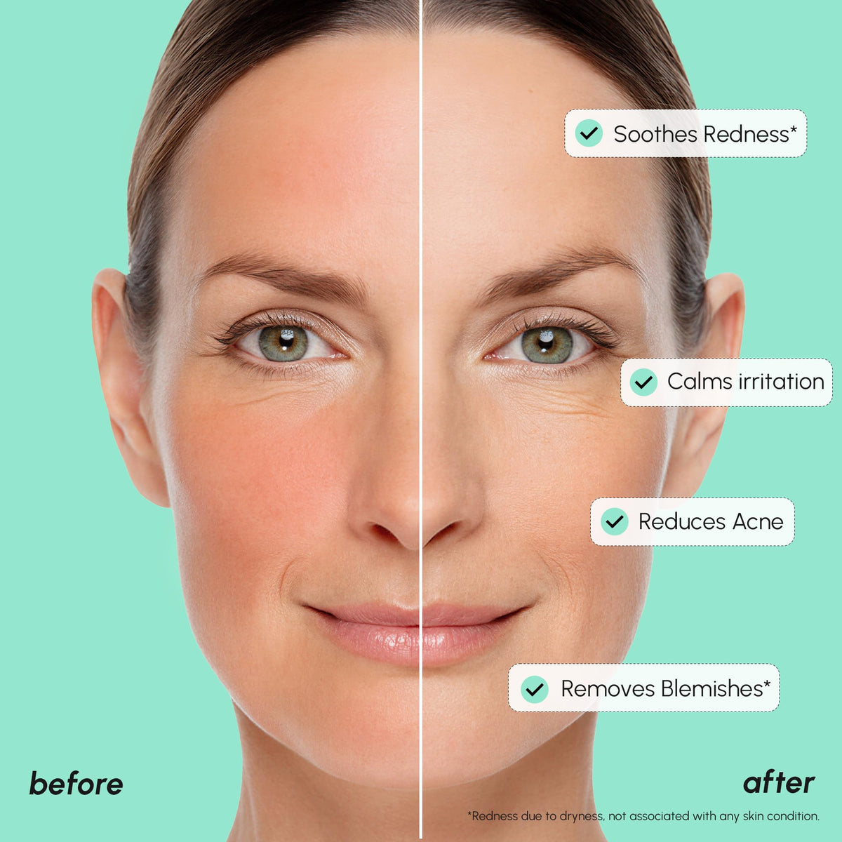 MAREE ingredient list label close-up showing azelaic acid and niacinamide benefit