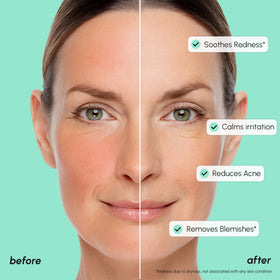 MAREE ingredient list label close-up showing azelaic acid and niacinamide benefit