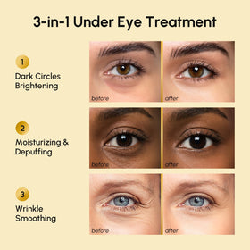 MAREE patches applied under-eye demonstrating cooling effect