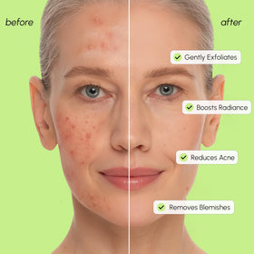 MAREE application in hand showing easy application and gentle exfoliation benefit