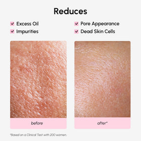 MAREE toner patch-test on inner arm showing skin tolerance and mild exfoliation