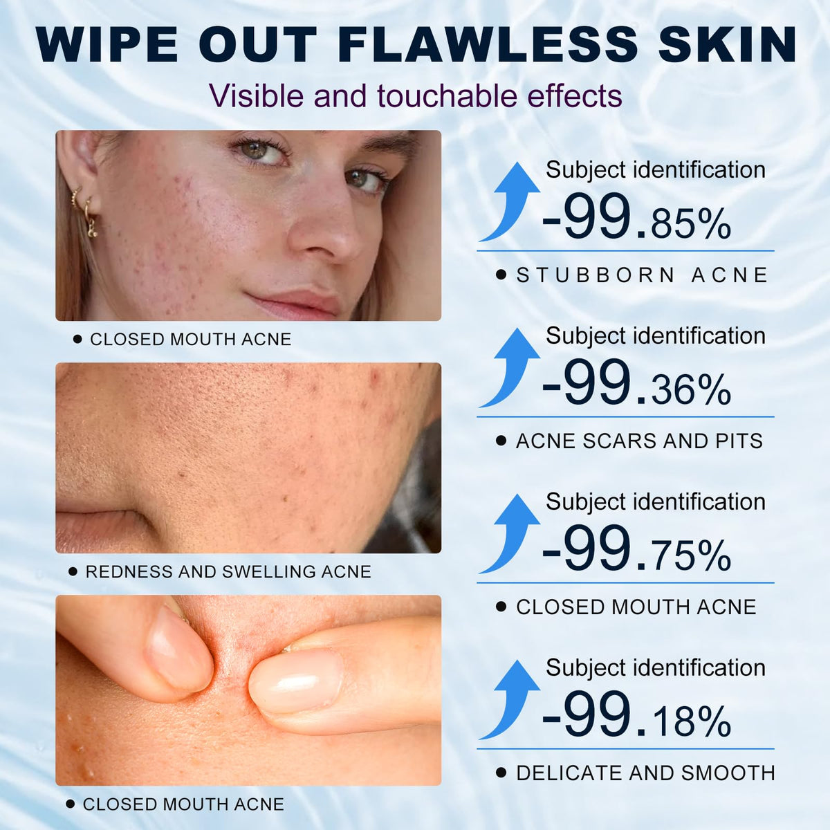 Marianp applying cream to cheek demonstrating targeted acne and redness relief
