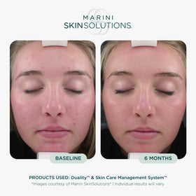 Marini SkinSolutions cream texture close-up showing smooth blend for even application