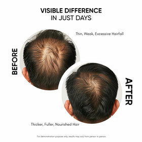 Masofta close-up texture of serum, lightweight fast-absorbing feel benefit