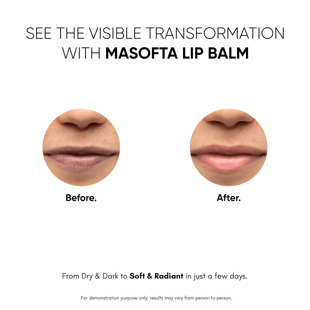 Masofta kojic acid ingredient visual, indicating pigmentation-targeting benefit