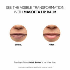 Masofta kojic acid ingredient visual, indicating pigmentation-targeting benefit