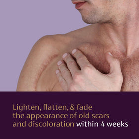 Mederma before-and-after scale showing visible scar improvement
