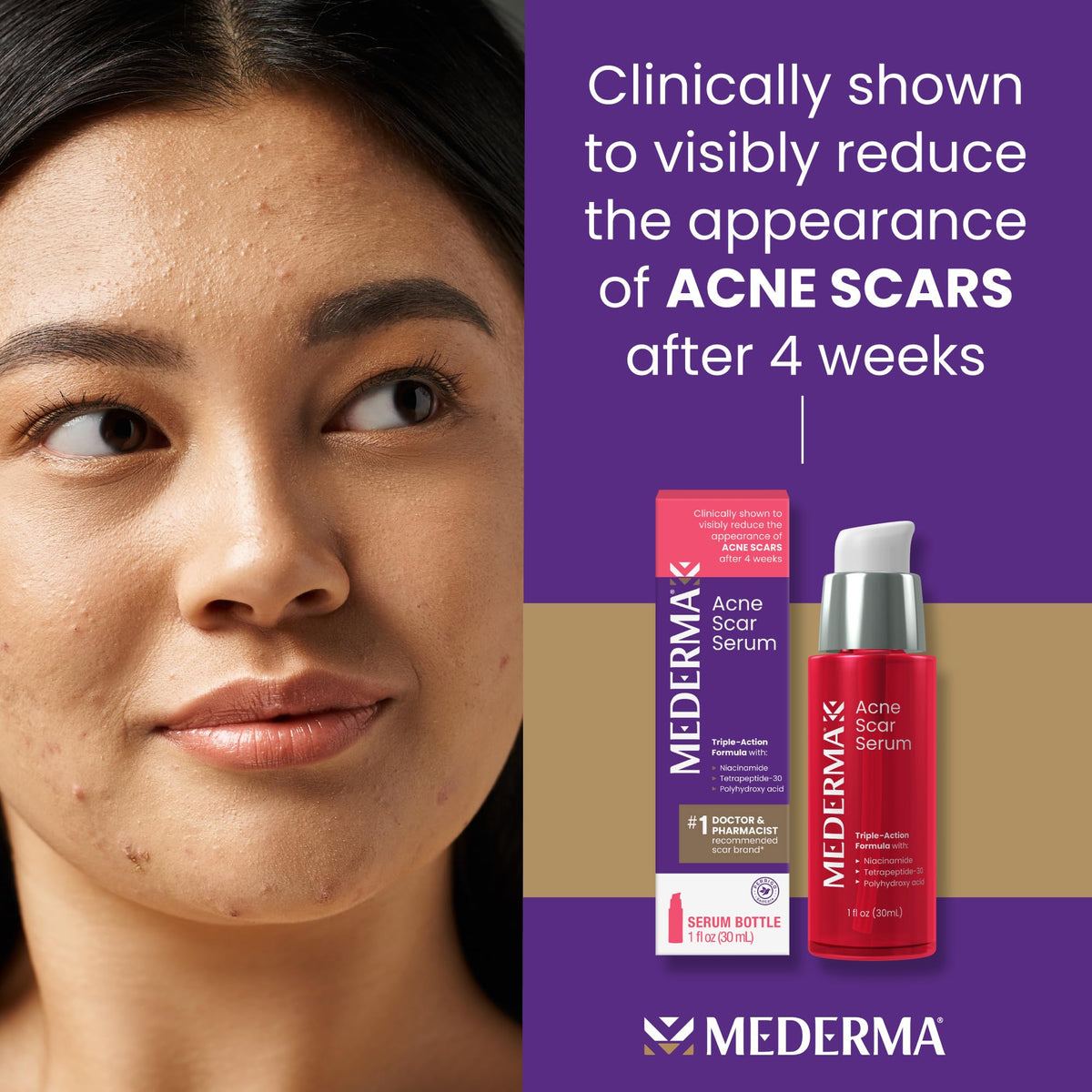 Mederma dropper dispensing serum demonstrating precise, hygienic application