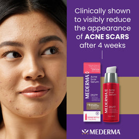 Mederma dropper dispensing serum demonstrating precise, hygienic application