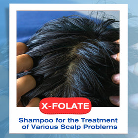 Mediceuticals X-Folate label close-up highlighting hypoallergenic formula