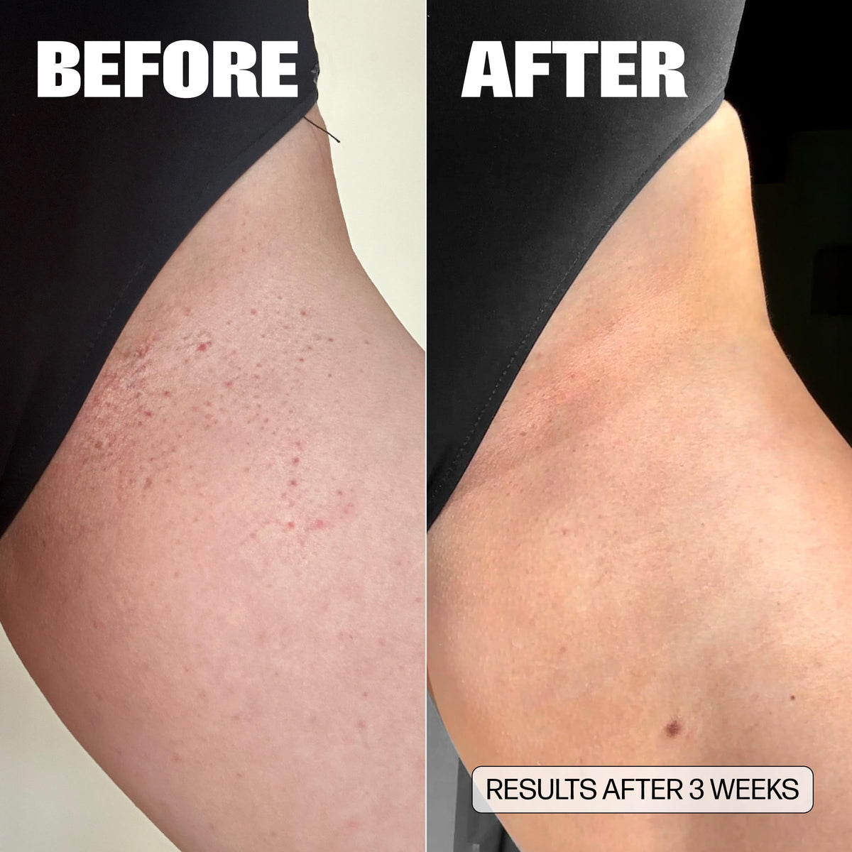 Medicine Mama's VMAGIC applied on hand illustrating easy massage-on use