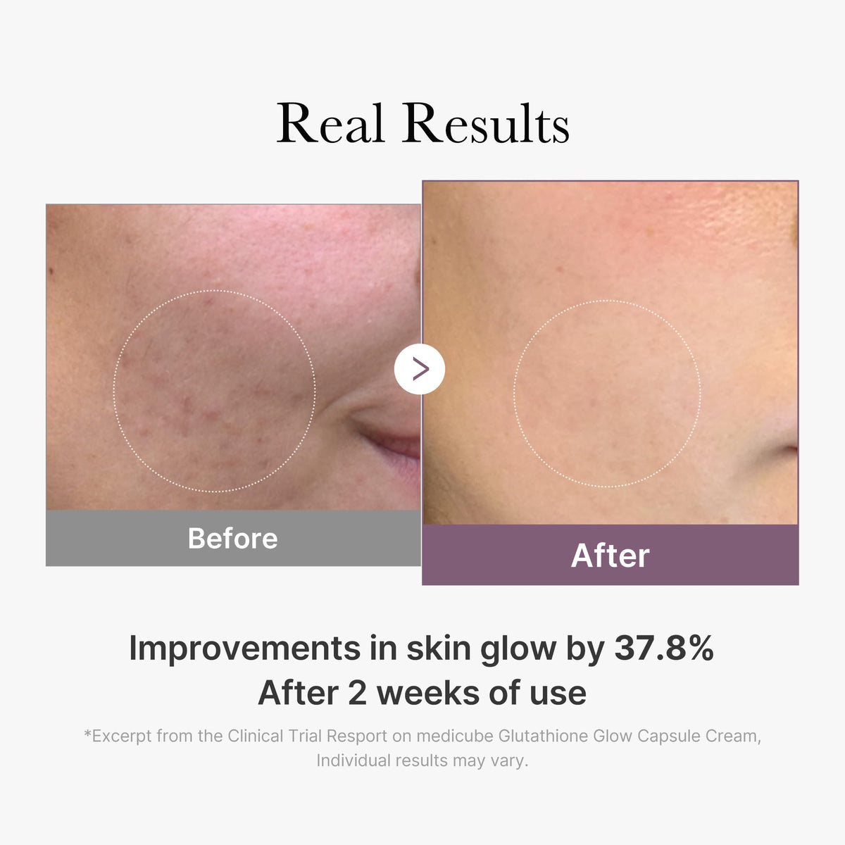 medicube before and after skin photo illustrating brighter tone and improved texture