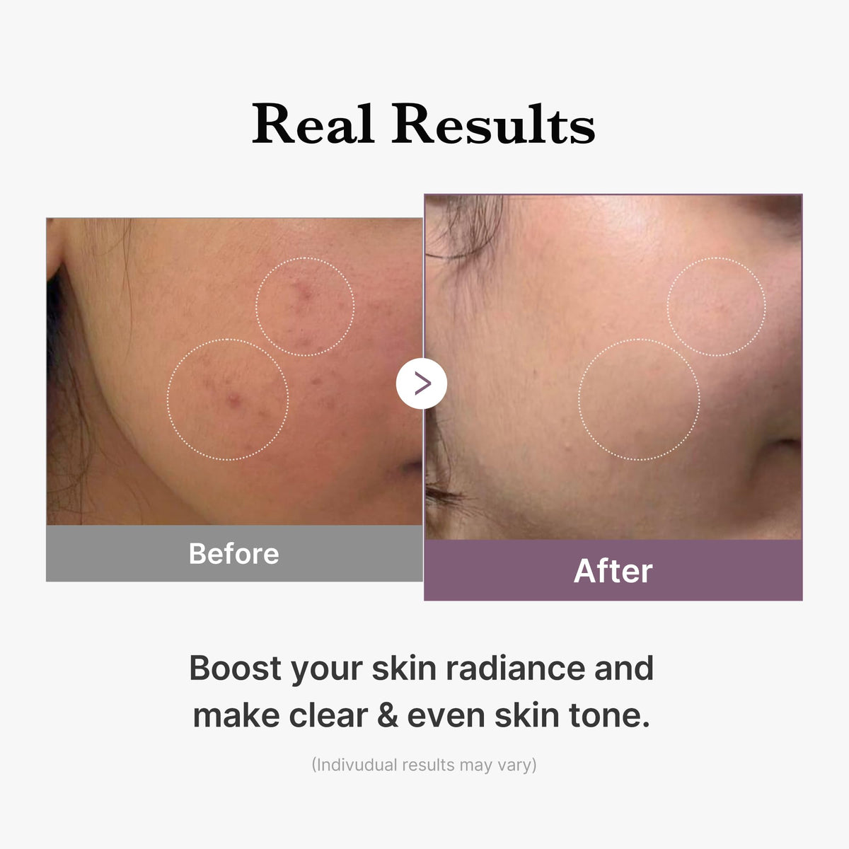 medicube milky texture on skin demonstrating quick absorption