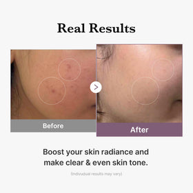 medicube milky texture on skin demonstrating quick absorption