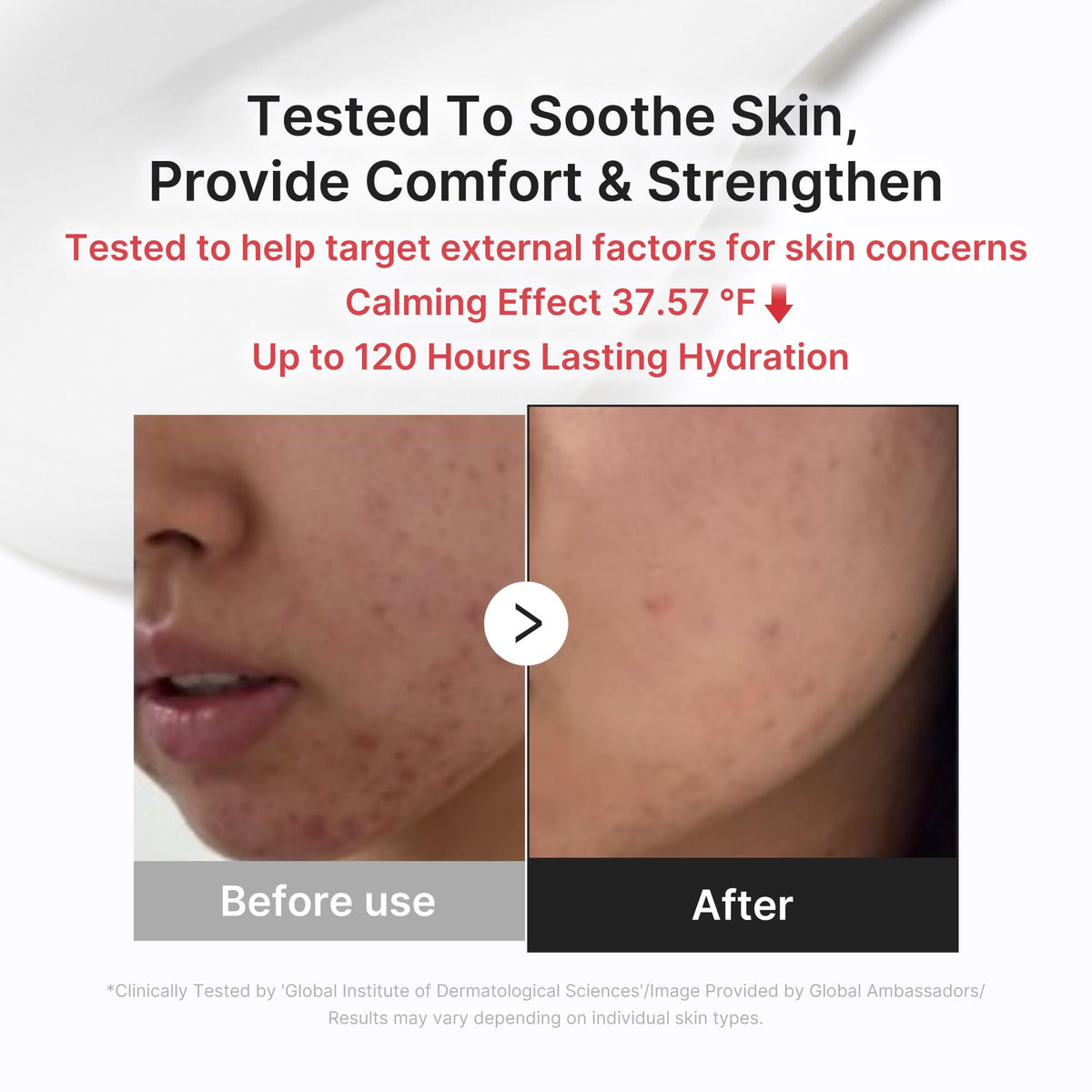 medicube applied after spot care to calm redness and protect skin