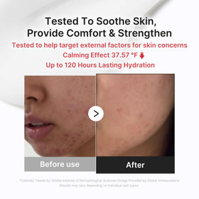 medicube applied after spot care to calm redness and protect skin