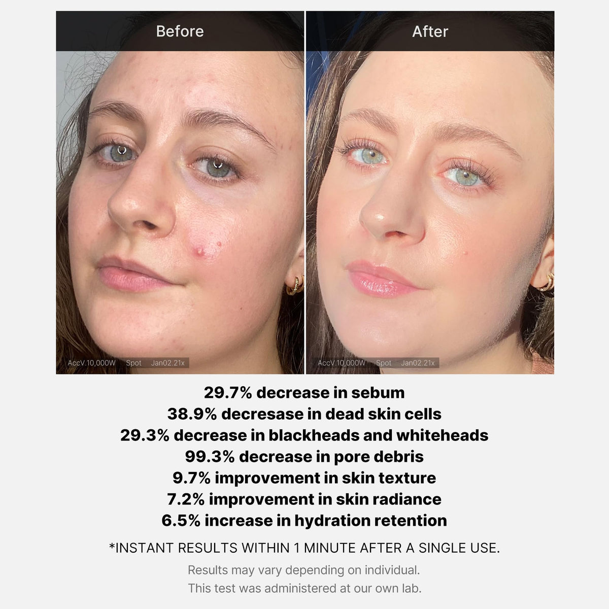 Medicube application in hand demo showing two-drop method for quick one-minute treatment