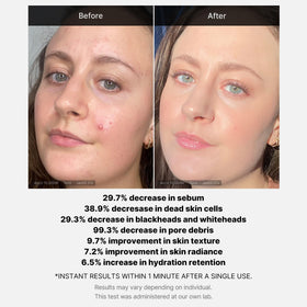 Medicube application in hand demo showing two-drop method for quick one-minute treatment