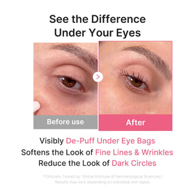 medicube model applying under-eye patch to reduce puffiness quickly