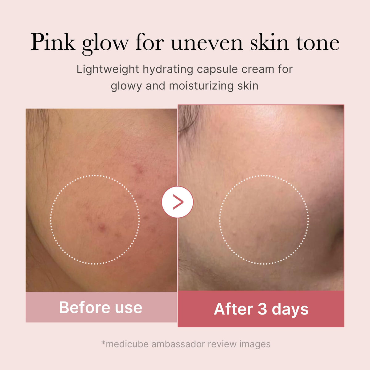 medicube capsule being popped into gel highlighting active release