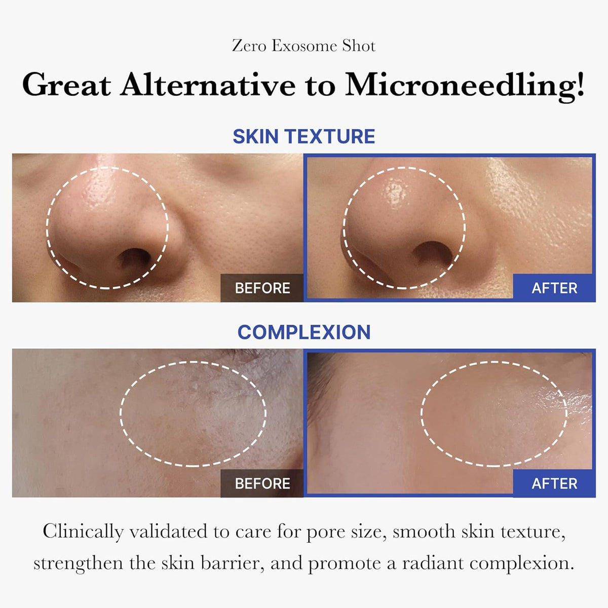 medicube spicule texture close-up revealing micro-needle delivery benefit