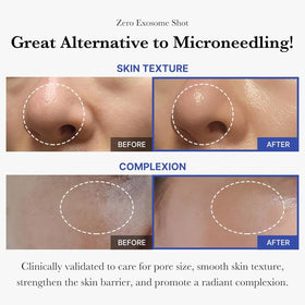 medicube spicule texture close-up revealing micro-needle delivery benefit