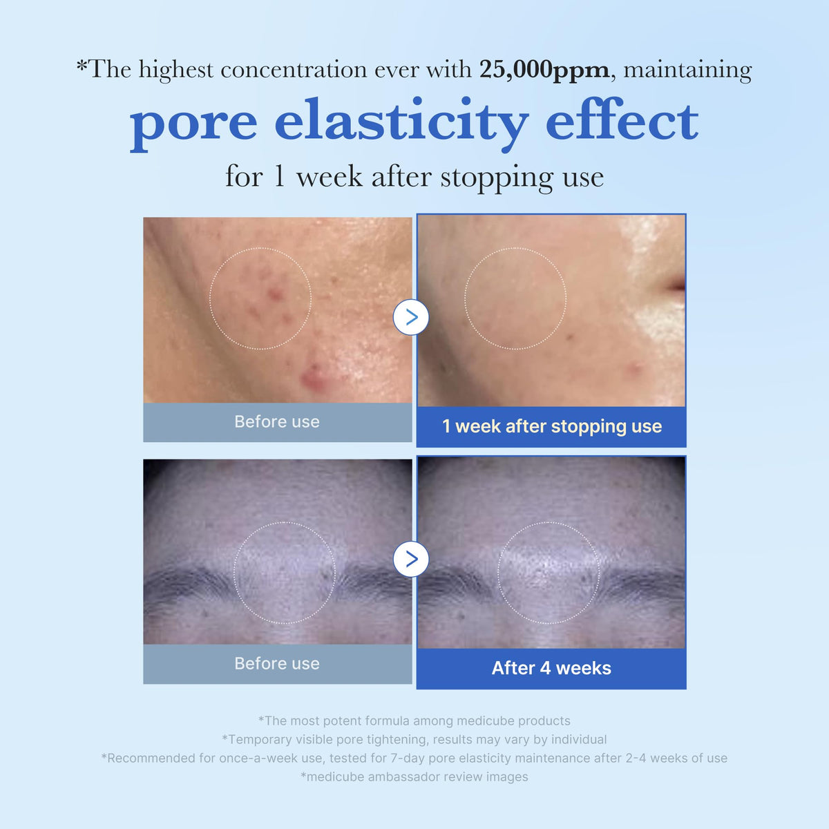 medicube close-up of micro-spicule texture highlighting delivery system benefit