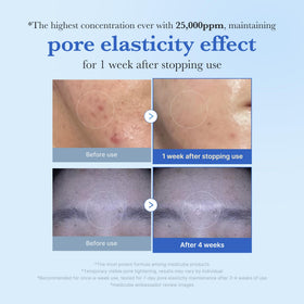 medicube close-up of micro-spicule texture highlighting delivery system benefit