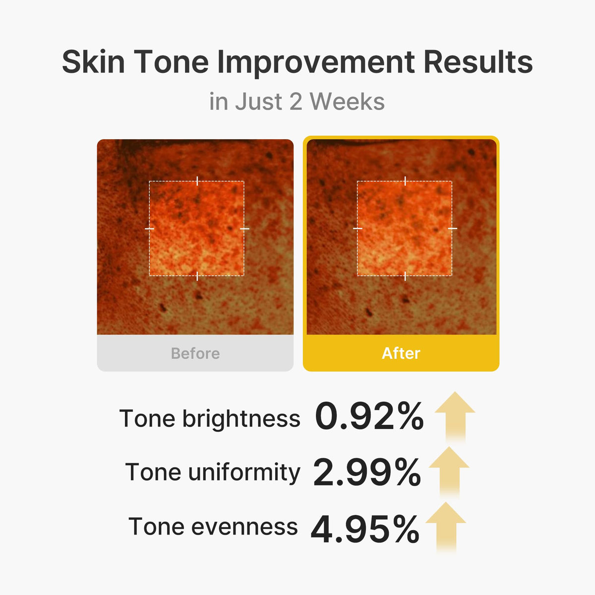 medicube turmeric and kojic ingredients arranged to show brightening benefit