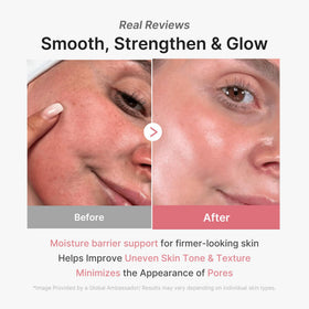 medicube model wearing mask demonstrating snug fit benefit