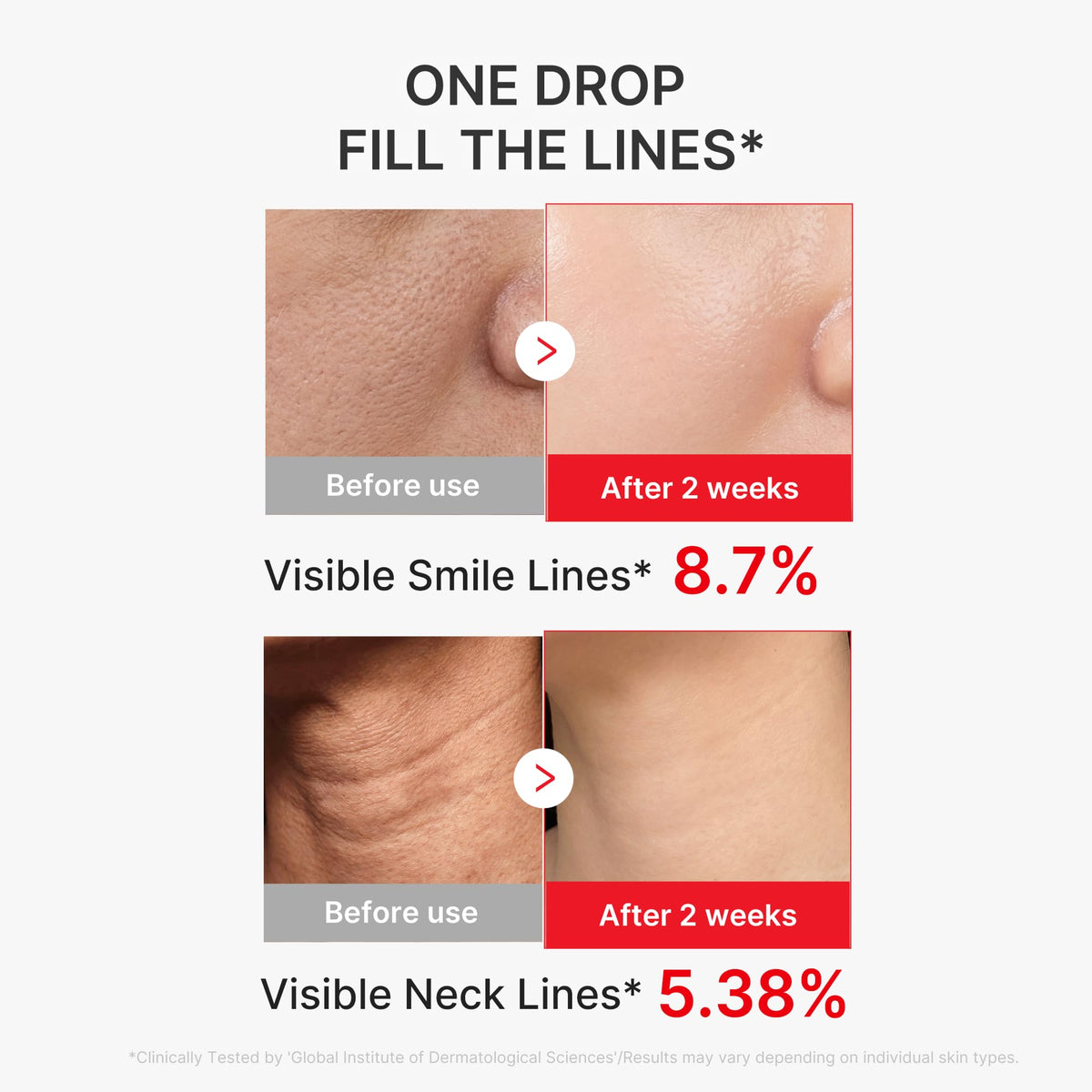 medicube applying serum to neck, illustrating targeted firming and lifting care