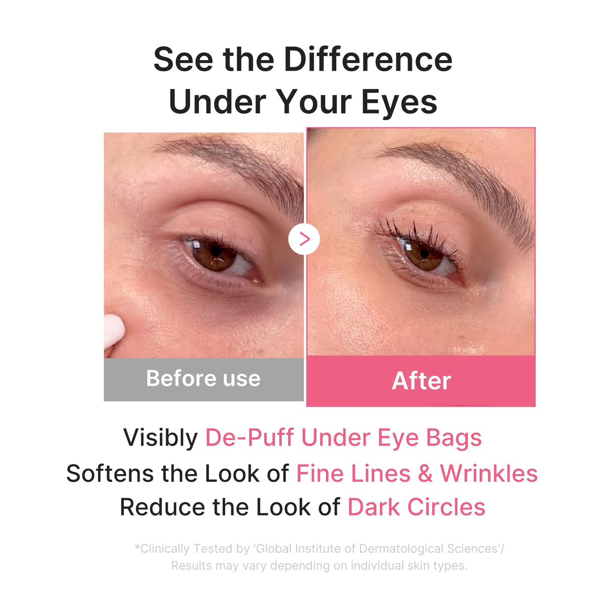 medicube patch on model eye demonstrating conforming fit and instant refresh