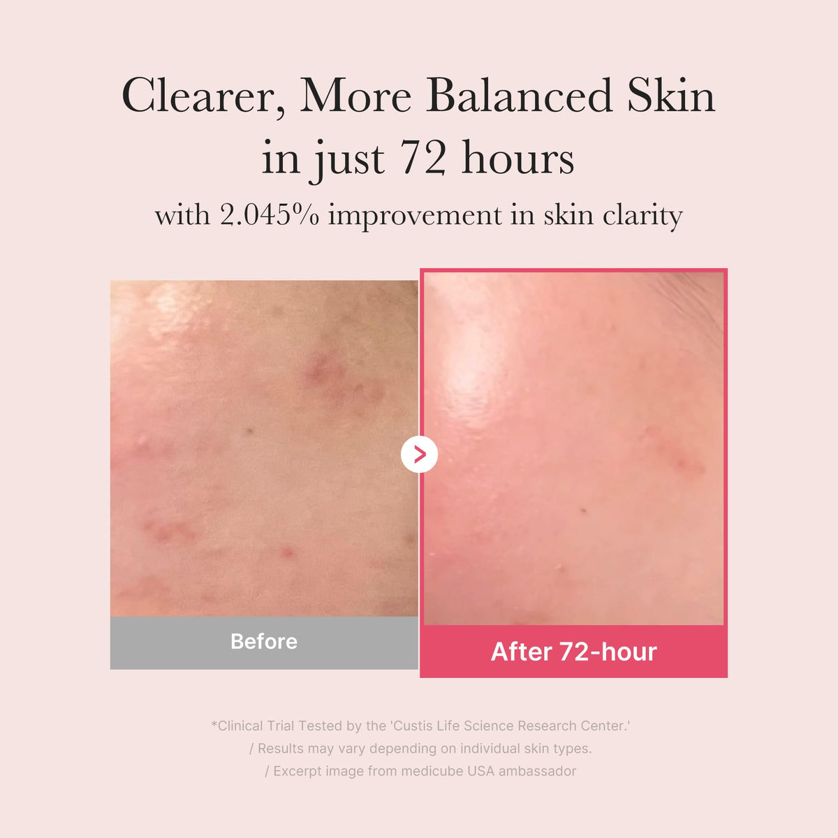 medicube pump dispensing serum demonstrating easy controlled application
