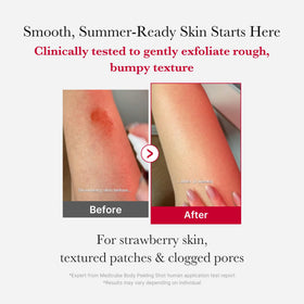 medicube spray nozzle close-up dispensing fine mist for even body coverage and easy application